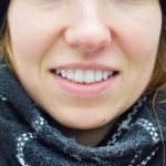 Woman with healthy teeth
